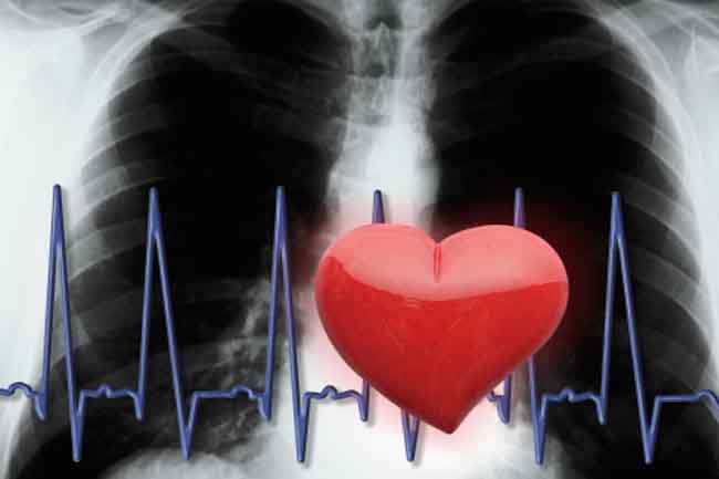 Preventing a Second Heart Attack